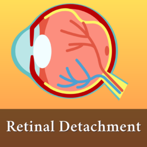 Urgent Warning: Understanding Retinal Detachment – A Sight-Threatening Emergency