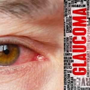 The Silent Thief of Sight: Understanding Glaucoma in India 2025