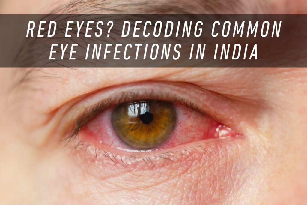 Decoding Common Eye Infections in India